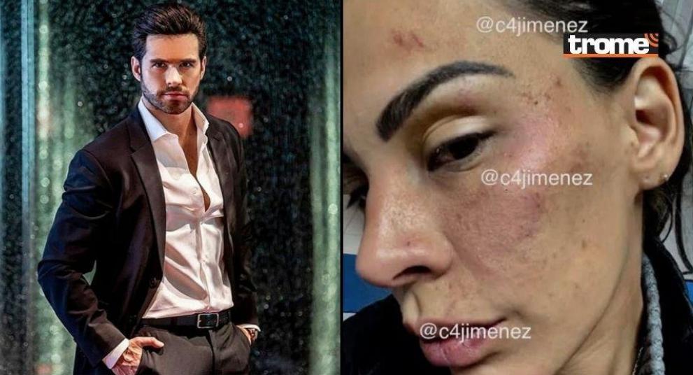 Dan libertad condicional al actor Eleazar Gómez tras reconocer que golpeó a ex novia