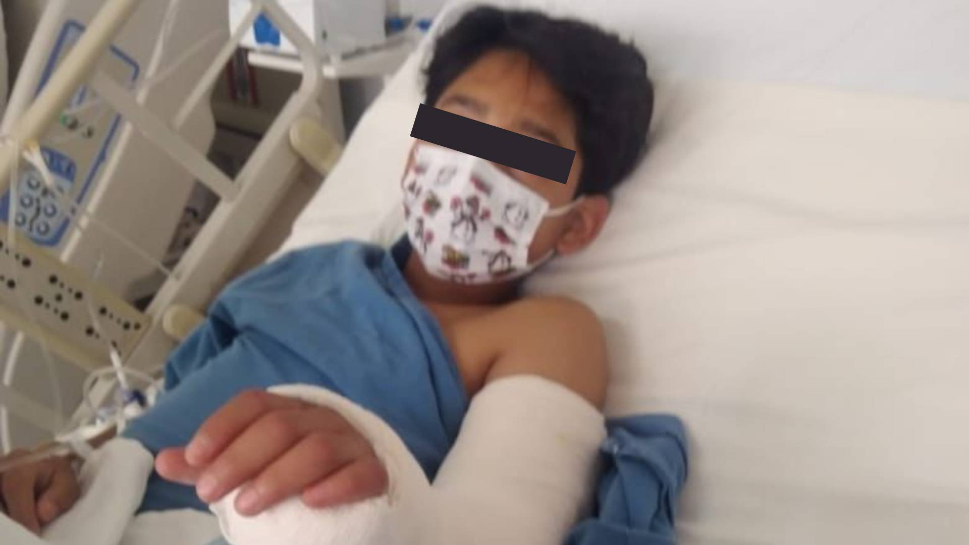 Trabajadora del Tren Maya pide ayuda por hijo lesionado en Tepetlaoxtoc