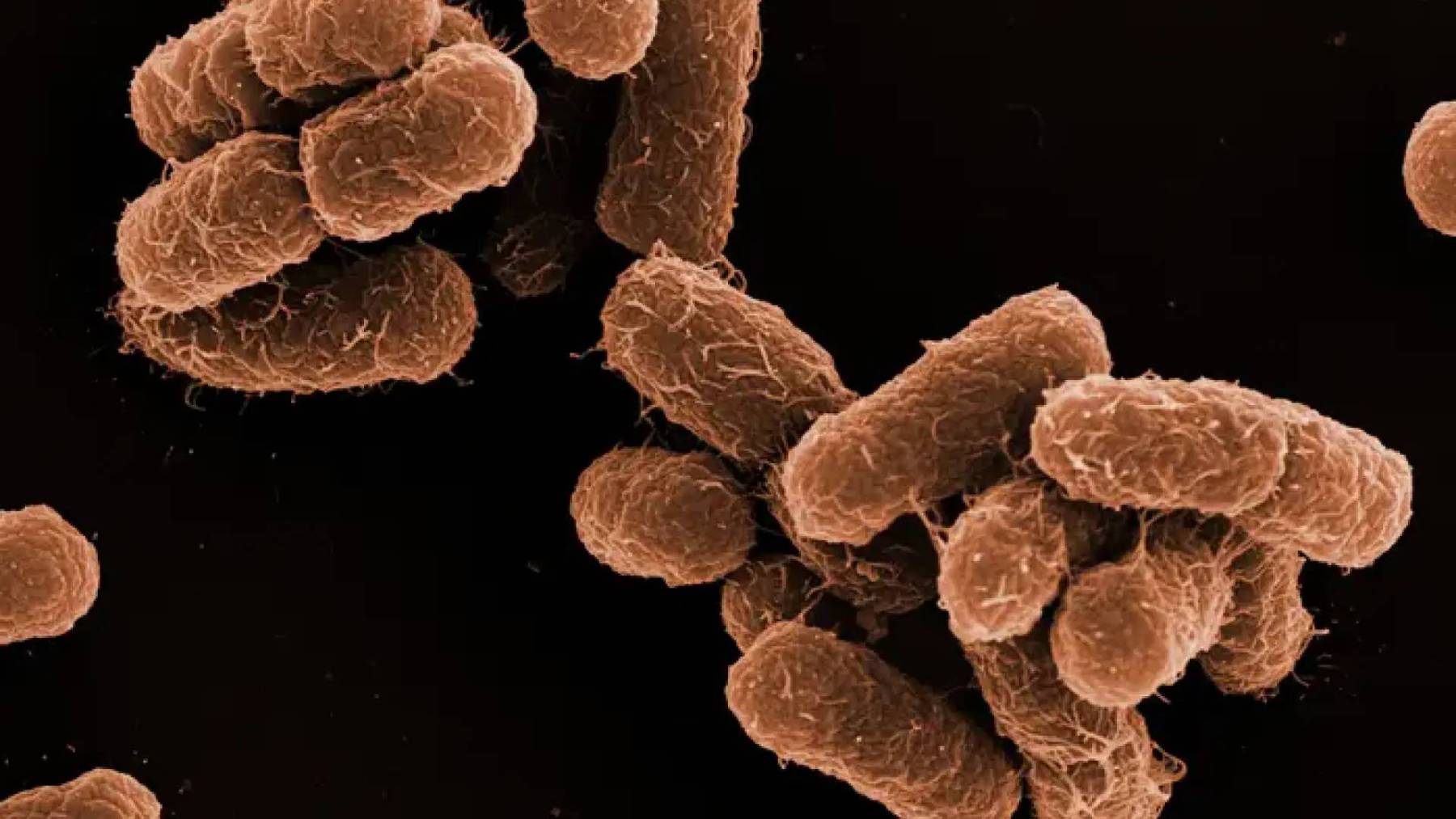 Cofepris investiga origen y medidas sanitarias del Brote de Klebsiella oxytoca