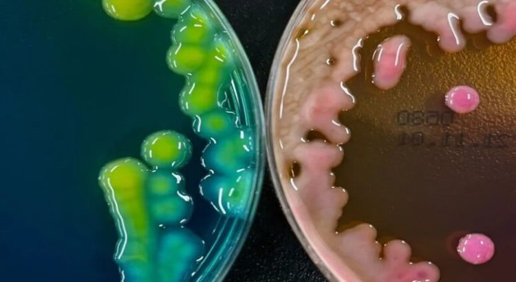 ¿Cómo se transmite la bacteria Klebsiella oxytoca?